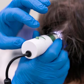 Консультация + трихоскопия