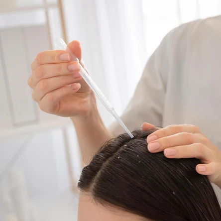 Комплекс при андрогенетической алопеции